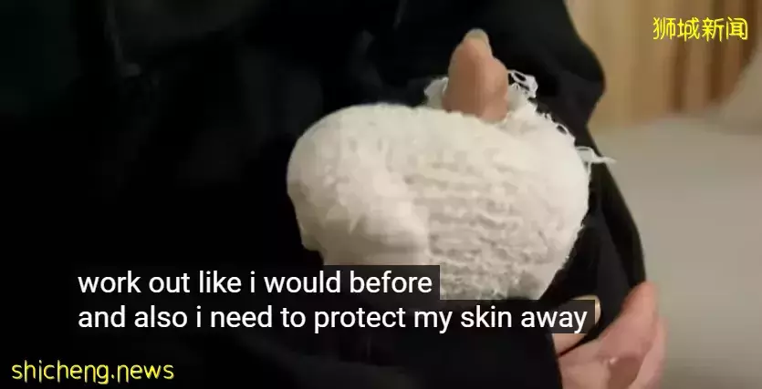 新加坡“宝马车祸”烧伤女孩首露脸!4个月,做了40多次手术