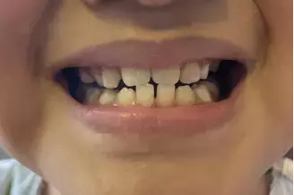 在全球最貴的新加坡，怎麽看病才能省錢？我女兒看病的這些事