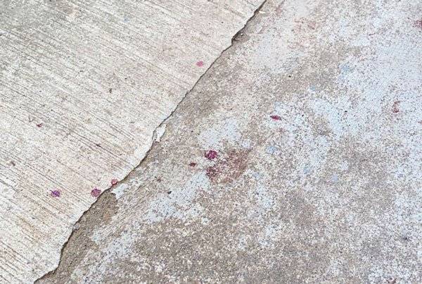 脚踏车撞女童伤左眼 18岁送餐员被捕