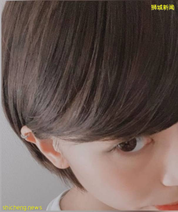 新加坡有人打完2針疫苗後,狂掉頭發!禿了