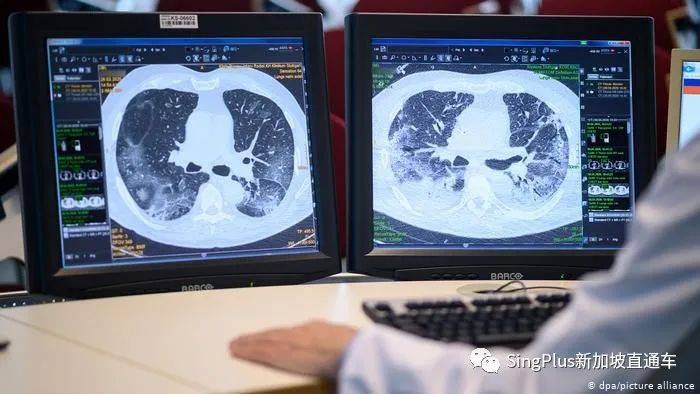 警惕！這個突變株致死率高了55%！新加坡已出現至少25例病例