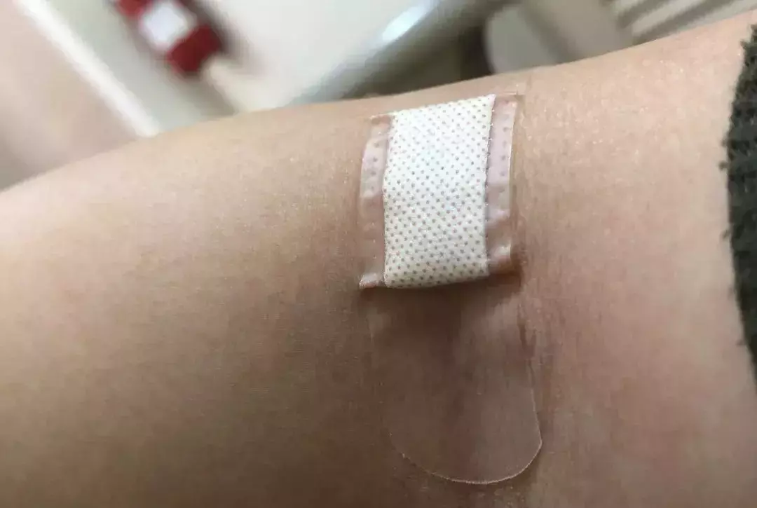 【苟活】我是新加坡第一個因爲大姨媽失血過多而進急診的衰狗嗎