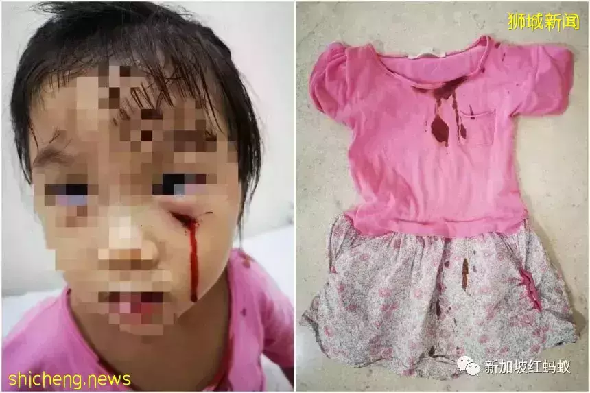 新加坡接连发生孔雀水獭伤人事件，引发舆论激辩到底该如何与野生动物共处