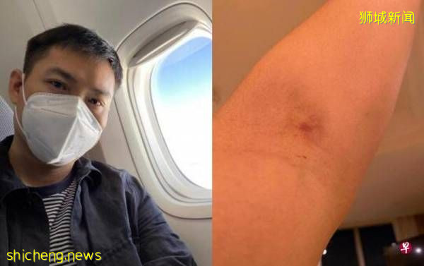 陈哲艺飞中国出差 每3天检测 手臂淤青