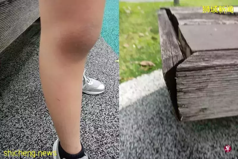 遊樂場凳子鐵釘暴露 兒小腿劃傷 父憂弄傷人