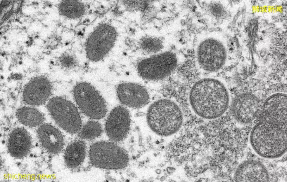 猴痘人传人,已对全球公共卫生构成中度风险