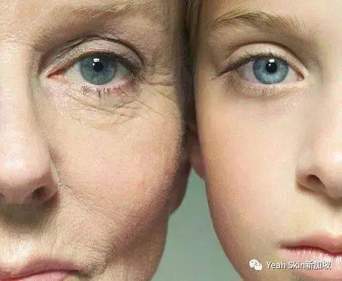 三重福利！贵妇级院线抗衰护理——法国FILLMED来新加坡啦