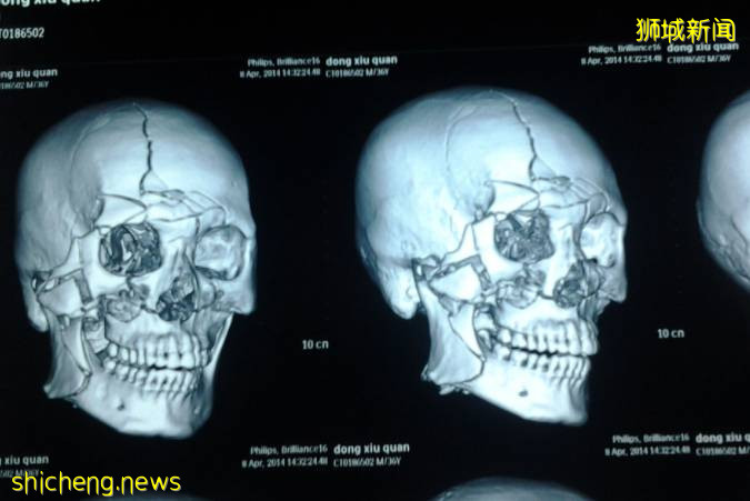 新加坡监狱内爆发斗殴,伤人者鞭刑+6年刑期!狱内实拍曝光