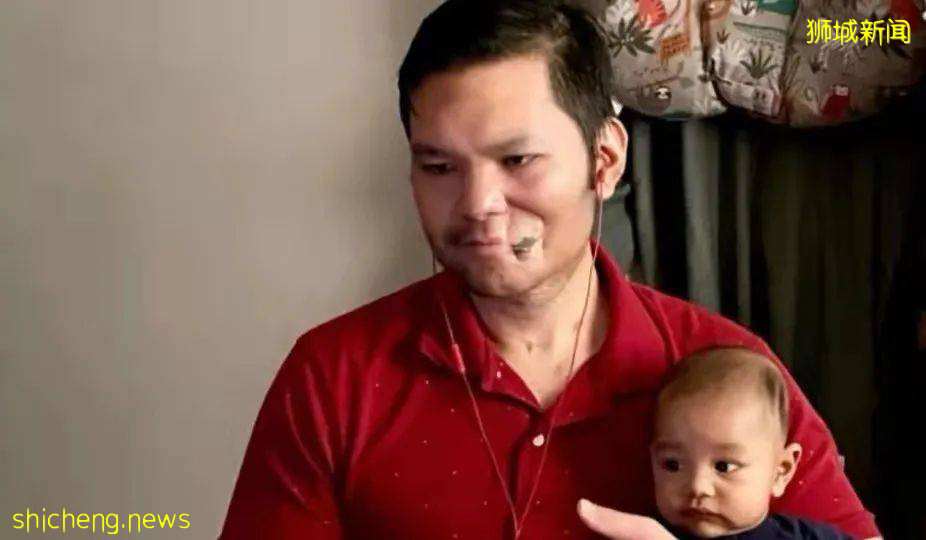 新加坡每年100人患口腔癌!医生建议公众定期检查