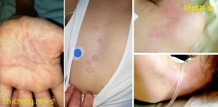 4岁儿子进ICU，新加坡母亲首发声！全岛5至11岁儿童将接种辉瑞疫苗