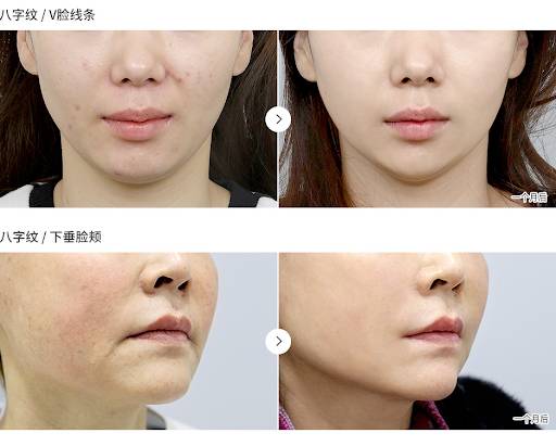 为什么那么多中国人来到新加坡后,变丑了