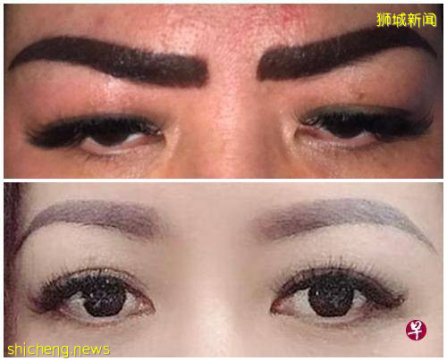 文眉后变得又粗又黑 女子申诉惨变“蜡笔小新”