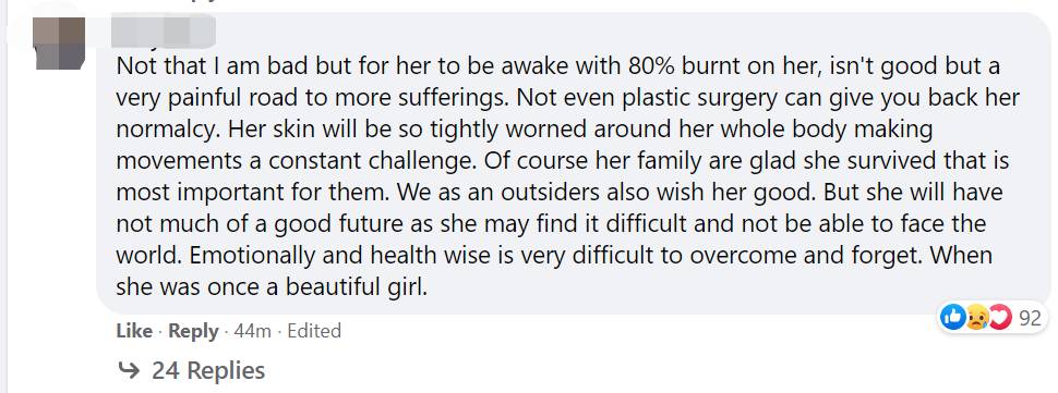 新加坡5死1伤车祸：为救男友80%烧伤的美女歌星，刚脱离危险！她还得面对这些