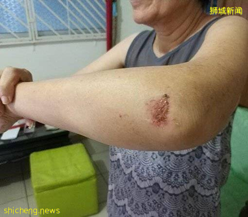 女送餐員騎電板車 撞至老婦手骨折