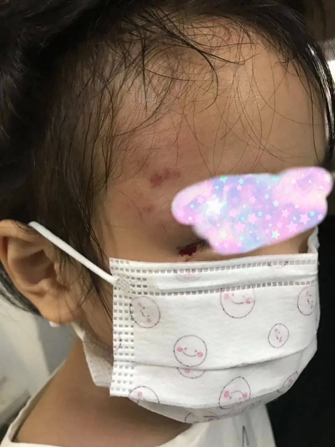 求助:2岁女儿眼睛在新加坡游乐场受重伤!1万多新治疗费!工作人员拒不负责!怎么办