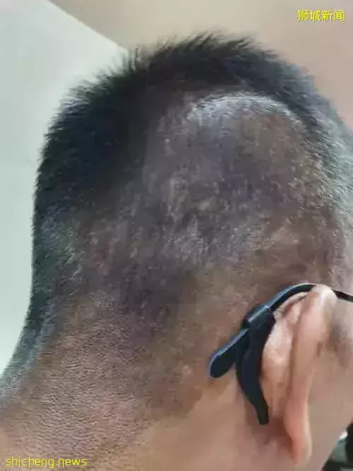 染剪發配套1771新元 阿伯稱遭誘簽 全家上門索退款