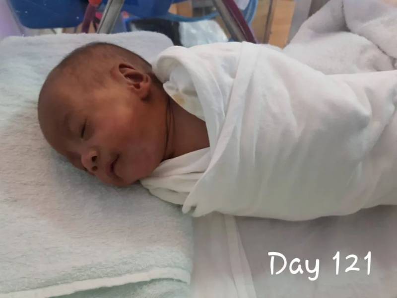 新加坡最輕早産兒僅345克，花了20多萬新幣才救活！新加坡看病到底有多貴