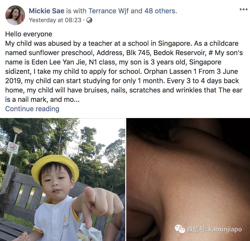 儿子身上多处瘀伤,母亲控诉新加坡幼儿园老师虐童!