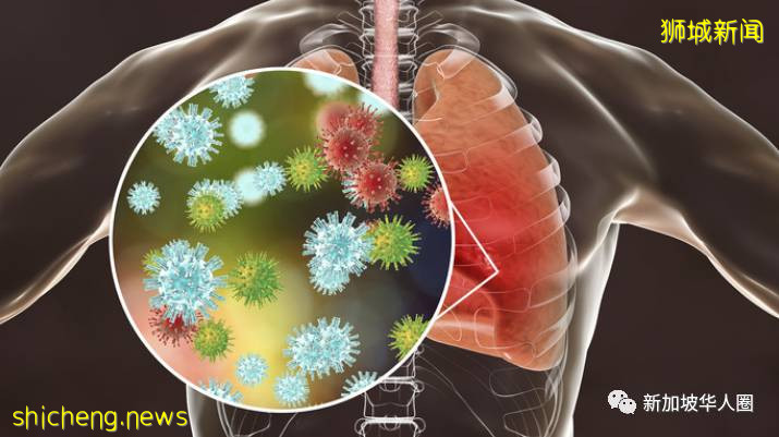 新增34例！​​新加坡有症狀者檢測僅0.03%確診！社區感染低基本受控