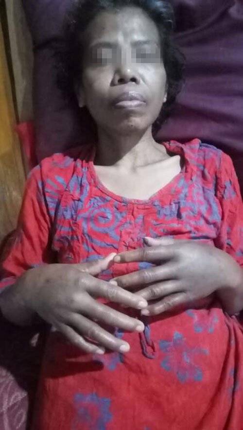 被雇主當出氣筒 Kakak全身骨折險失明