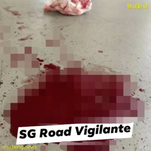 老人被电动车撞倒口罩都沾满了血,热心路人甲上线