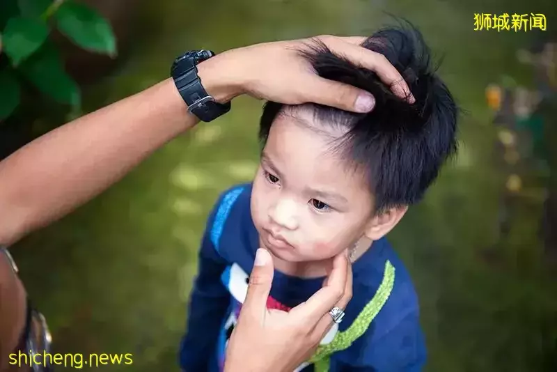 新加坡骨痛热症已近5500例!预防措施有哪些