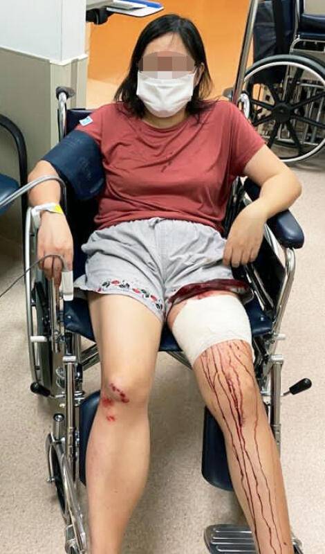 妇女回家途中被野猪袭击　獠牙刺伤左腿深可见骨