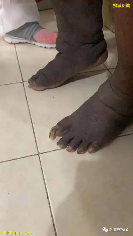 獅城患病母子住在破舊屋子　沒錢看醫生冰箱內全是黑色的東西!