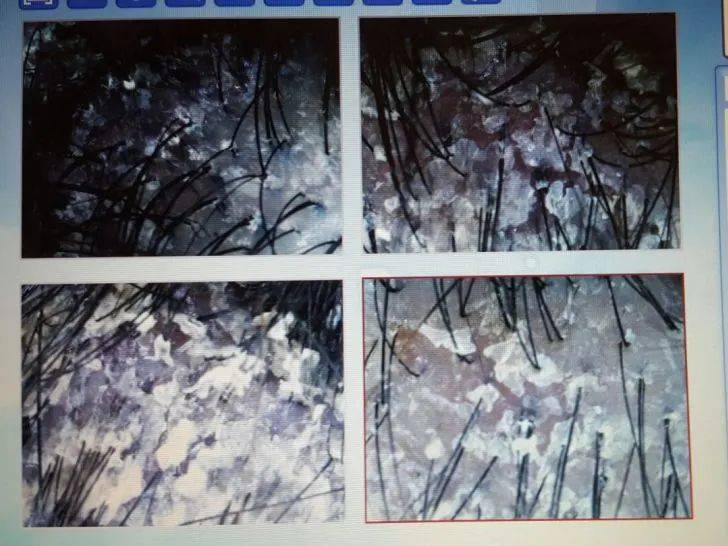 獅城這些“禿”如其來的煩惱,讓它幫你解決