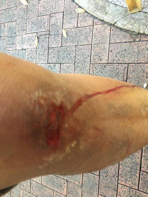 太慘了，回家路上從破井蓋掉下，到底是誰的錯