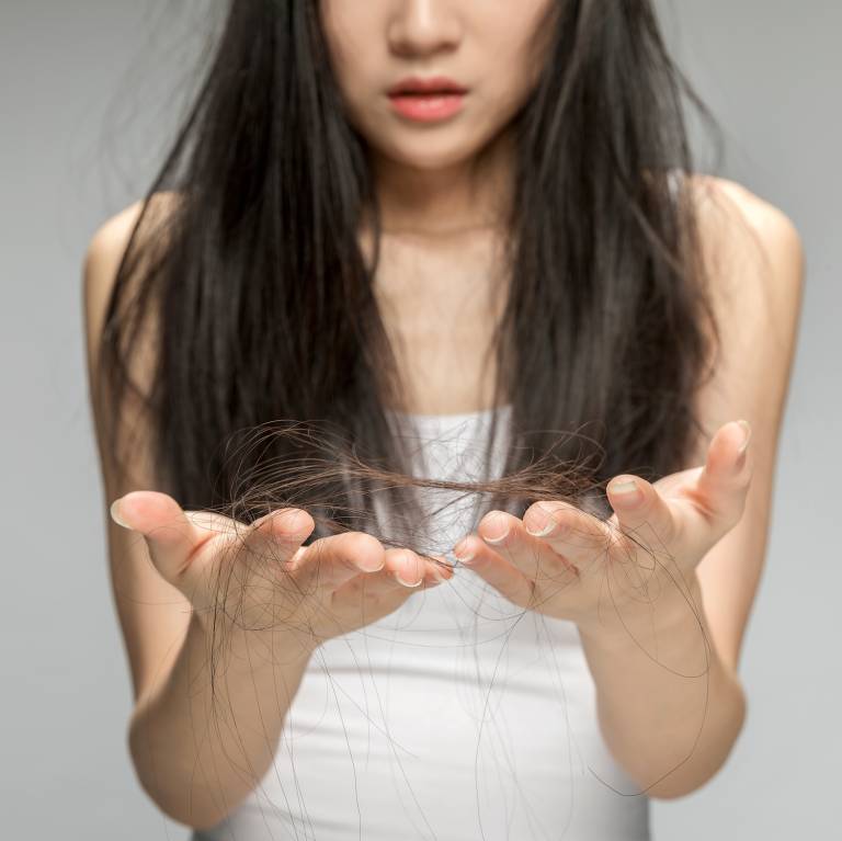 獅城這些“禿”如其來的煩惱,讓它幫你解決