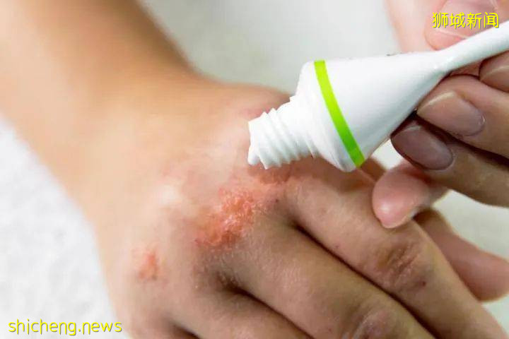 防疫勤洗手,也別忘了防它哦