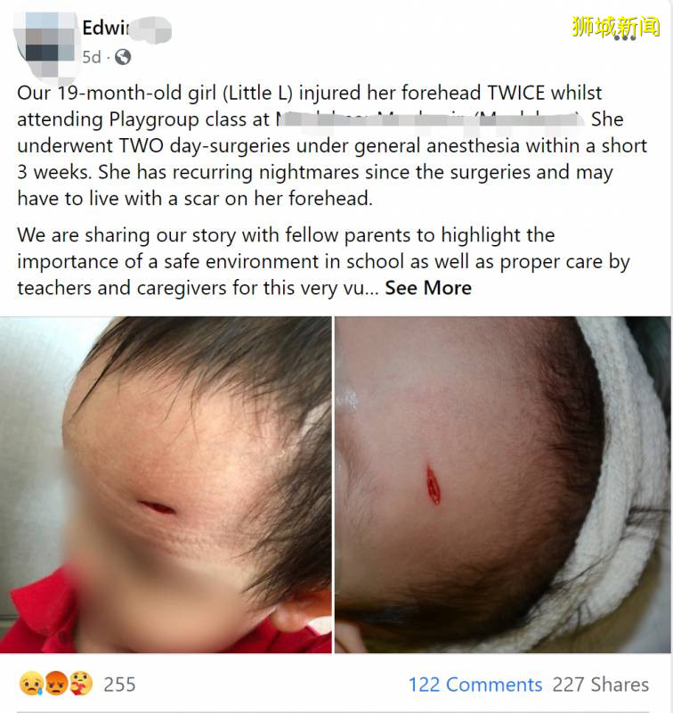 网友：一岁半的女儿在新加坡幼儿园受伤缝针，却没有人能说清楚