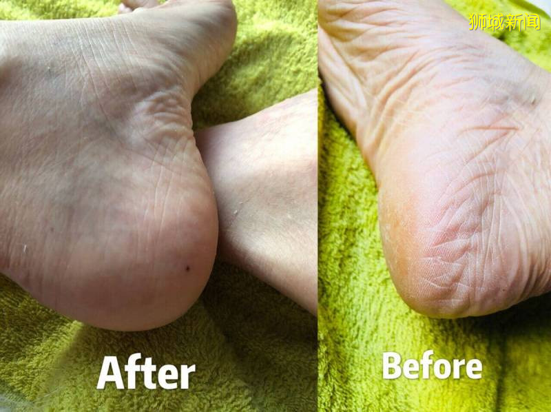 超劃算的去角質噴霧、植物酵素、斷貨面膜!去日本才買得到的神奇好物集體上架新加坡官方旗艦店啦