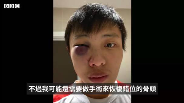 國際形勢劇變,新加坡或許是留學生更好的選擇