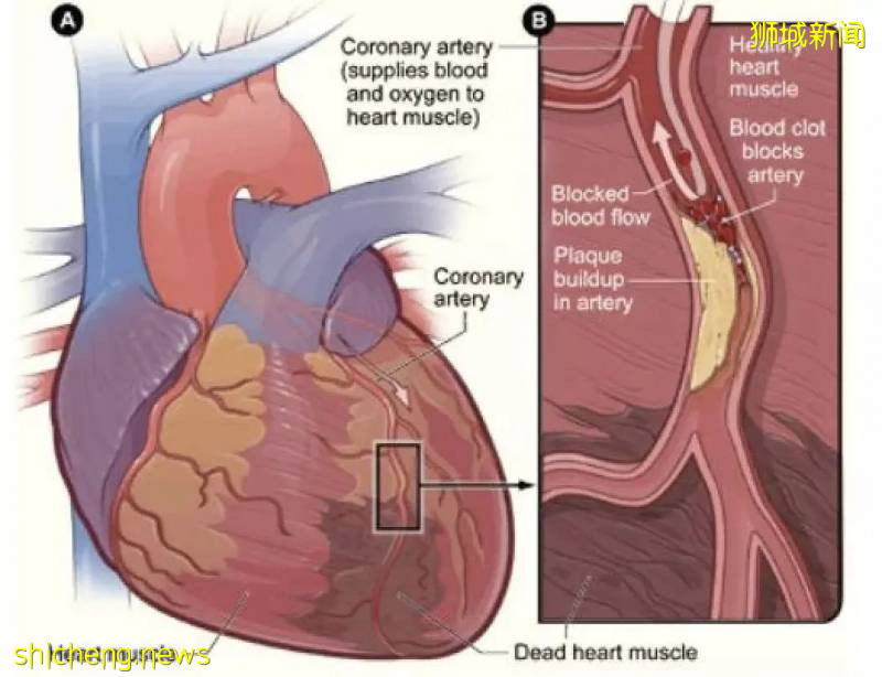 客工患病后坠楼身亡！多名客工死于非新冠引起的并发症