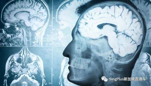 過敏、面癱、腦脊髓炎……是時候談談新冠疫苗的不良反應了