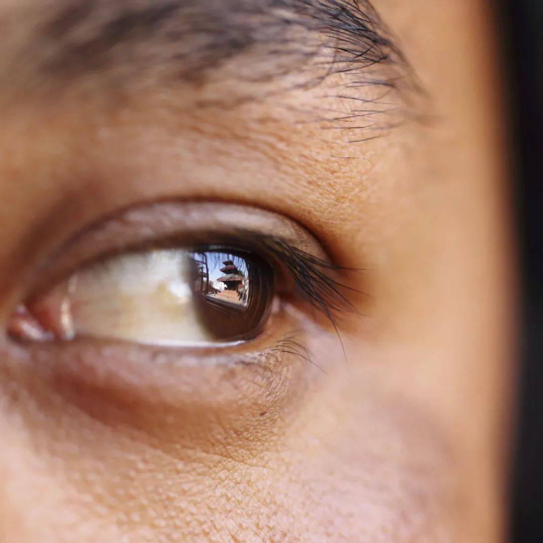 新加坡女子出現這個症狀後,竟確診新冠