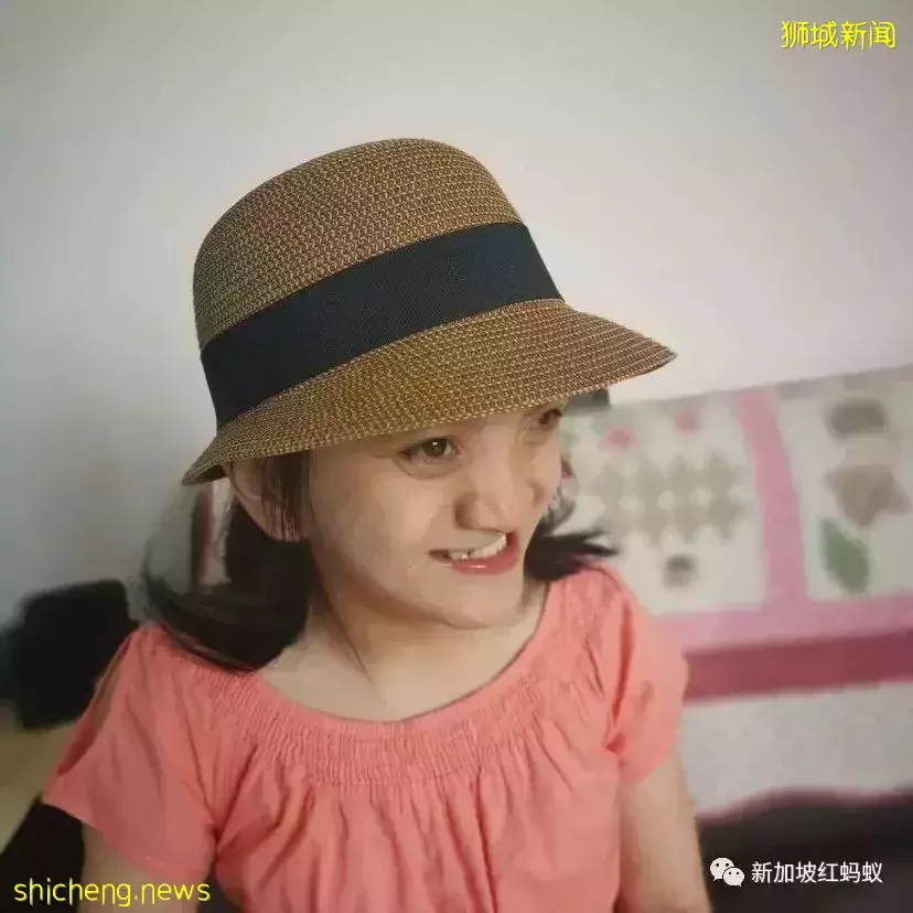 长期照顾特需孩子需极大勇气和耐心 对任何一个家庭都不容易