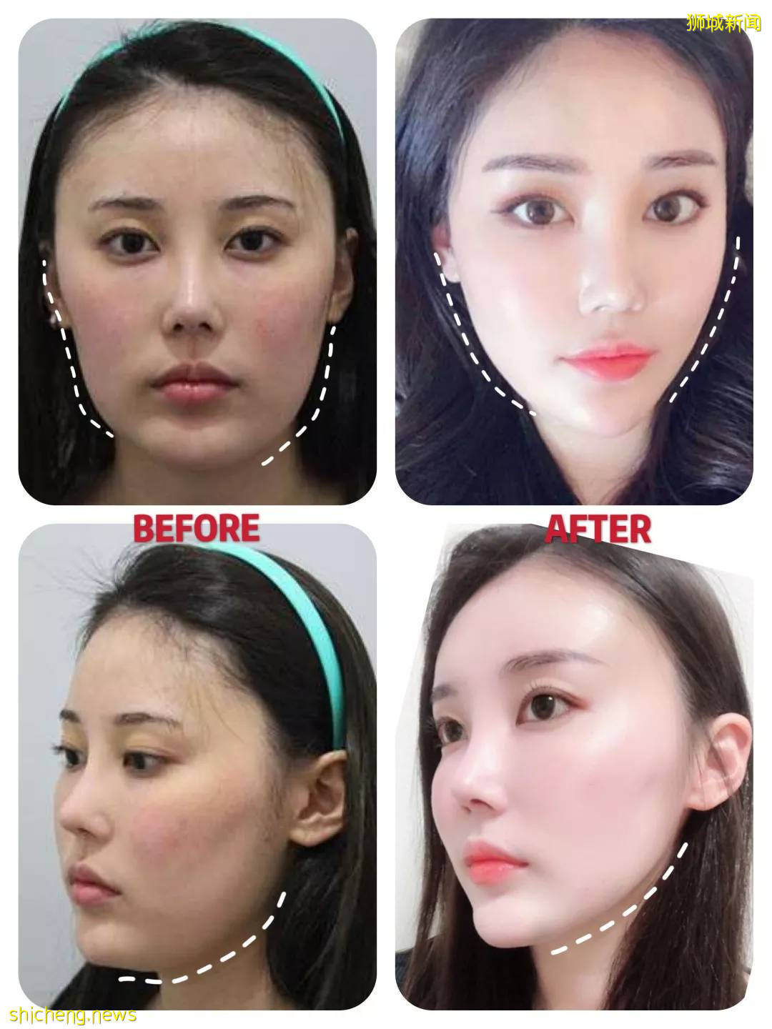 新加坡童年女神隐婚10年，41岁嫁富豪老公，50岁美成了天仙