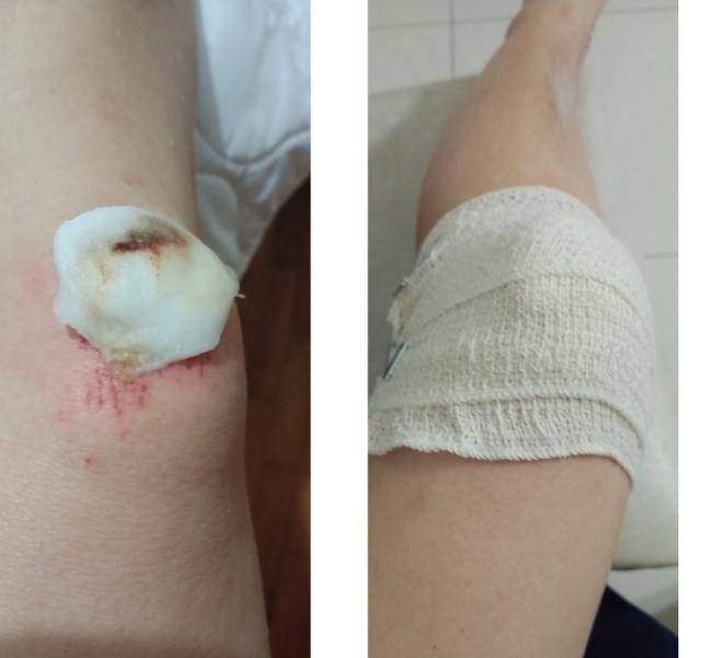 公园夜跑被绊倒,新加坡政府处理流程全记实