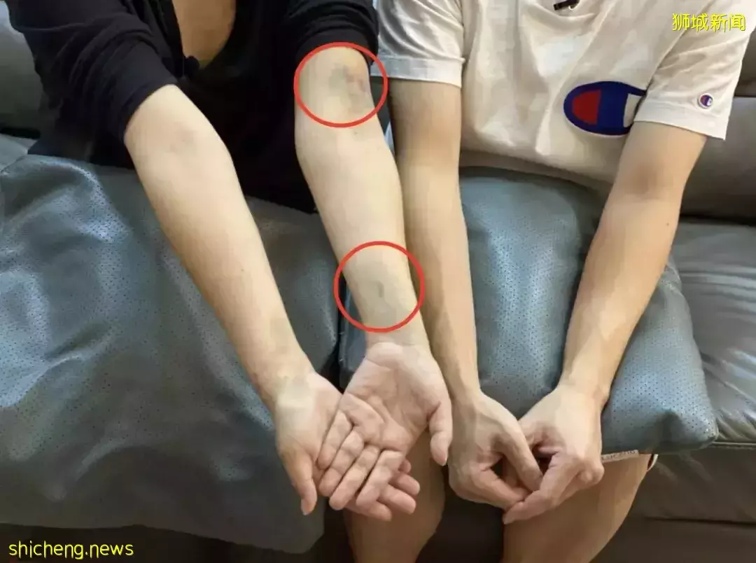 “新冠孕婦”流産真相曝光,衛生部長發文致歉!新加坡看病有多貴:小檢查要花5000新幣