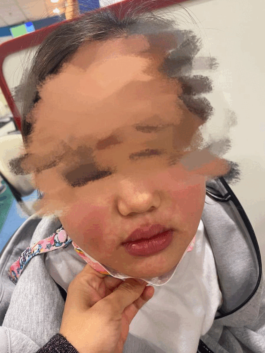 緊急求助！“娃全身紅疹，被新加坡醫生要求全麻開刀！我該怎麽辦？”