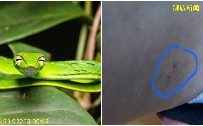 登山妇走近草丛  闪避人群反遭蛇咬