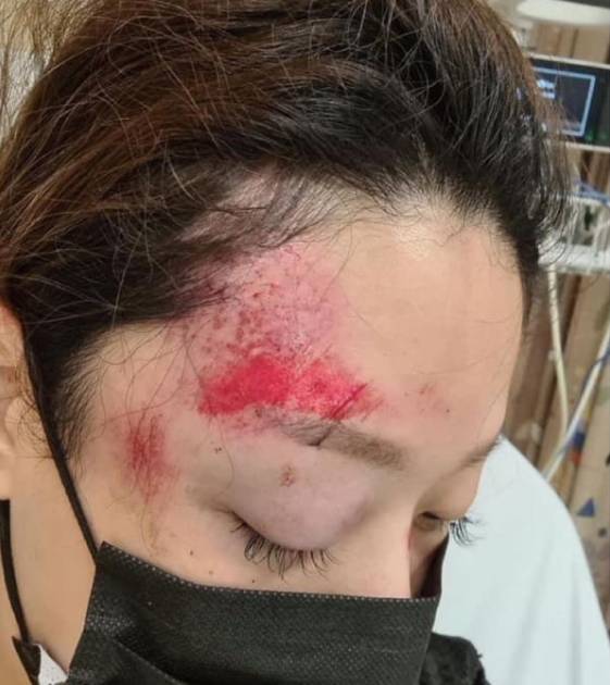 骑手酿祸端后逃逸，女子上网寻目击者