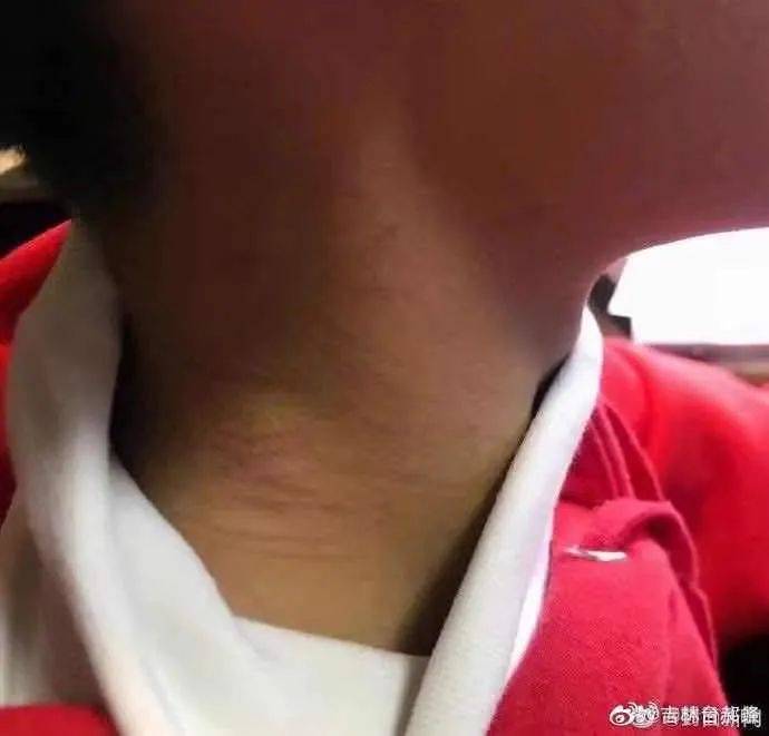 警察下跪震驚全網,實拍昆明人質劫持案有多驚心動魄!新加坡的警察也曾這樣做