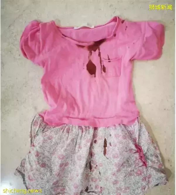 新加坡孔雀啄伤女童事件更多细节流出，伤口长三公分、主人后院全是禽类