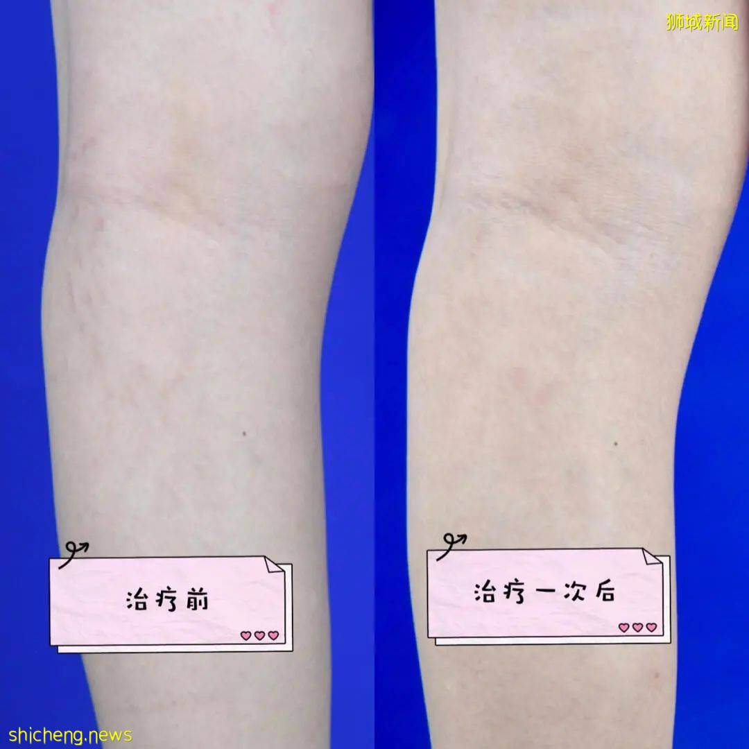 新加坡童年女神隐婚10年，41岁嫁富豪老公，50岁美成了天仙