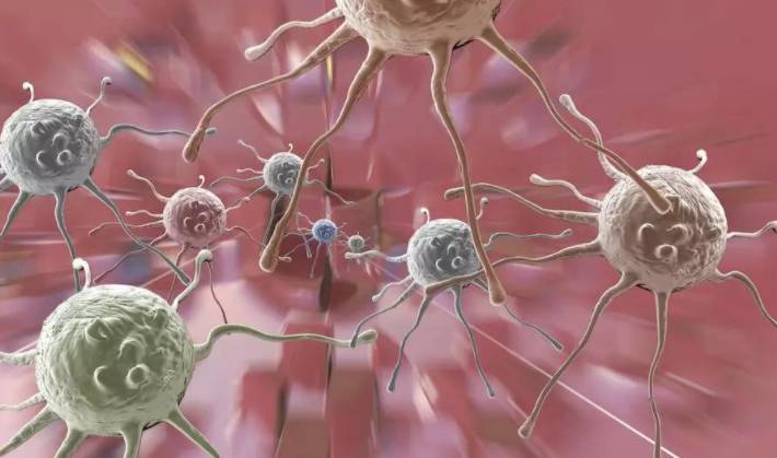 新加坡國大研發出新技術,可利用人工智能辨別癌細胞