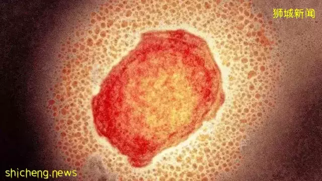 猴痘肆虐!无针对治疗方法!新加坡将保持高度警惕